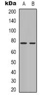 BTK Antibody (Internal)