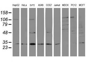PSMB7 Antibody (aa58-277, clone OTI1D1, Carrier-free)
