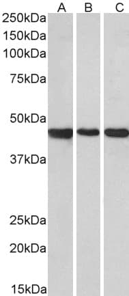 IHC-plus™ PROKR2/Prokineticin Receptor 2 Antibody (aa5-15)