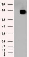 APP / Beta Amyloid Precursor Antibody (clone OTI7B8)
