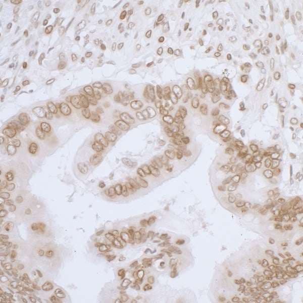 TMPO / TP / Thymopoietin Antibody (aa1-50)