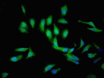 Polyclonal Rabbit anti-Human C1GALT1C1 Antibody (IHC, IF, WB)