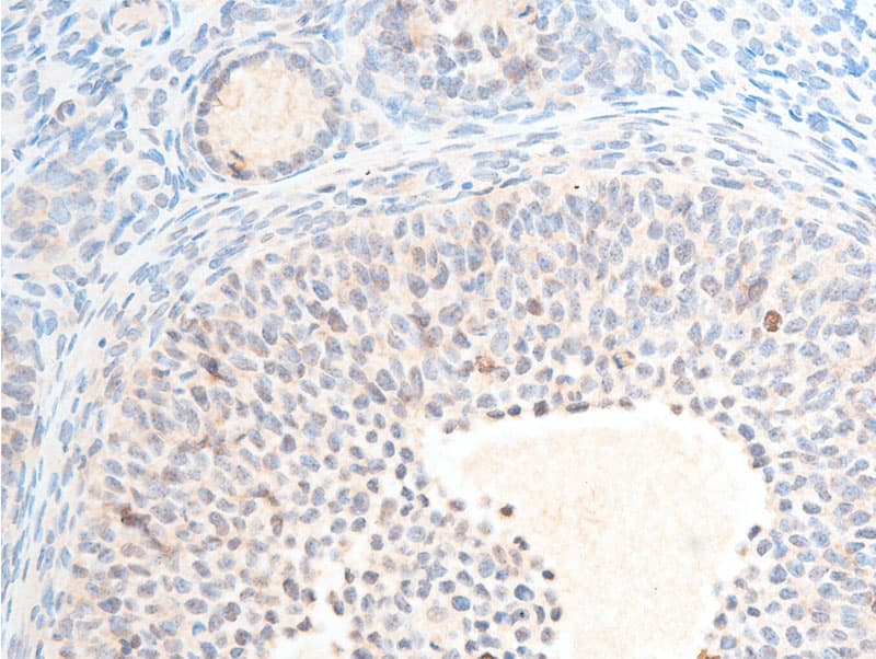 CHEK2 / CHK2 Antibody (phospho-Thr387)