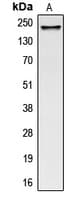 COL5A1 / Collagen V Alpha 1 Antibody (Internal)