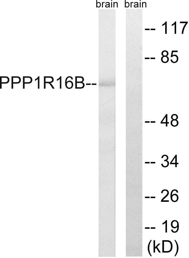 PPP1R16B Antibody