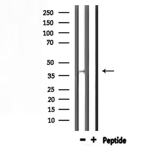 AWAT1 / DGAT2L3 Antibody