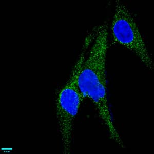 MCAM / CD146 Antibody