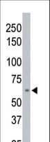 PPM1D / WIP1 Antibody (aa571-602)