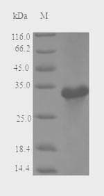 Apple Major allergen Mal d 1 Protein (Recombinant 6His-SUMO, N-terminus)