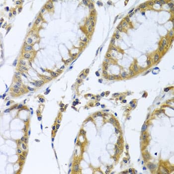 FBXL5 / FBL5 Antibody