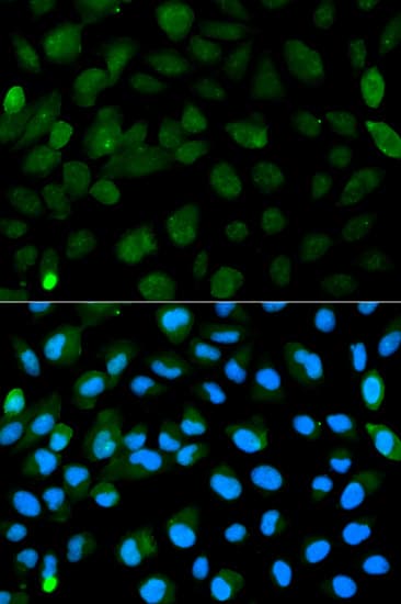 IHC-plus™ Polyclonal Rabbit anti-Human PML Antibody (IHC, IF, WB)