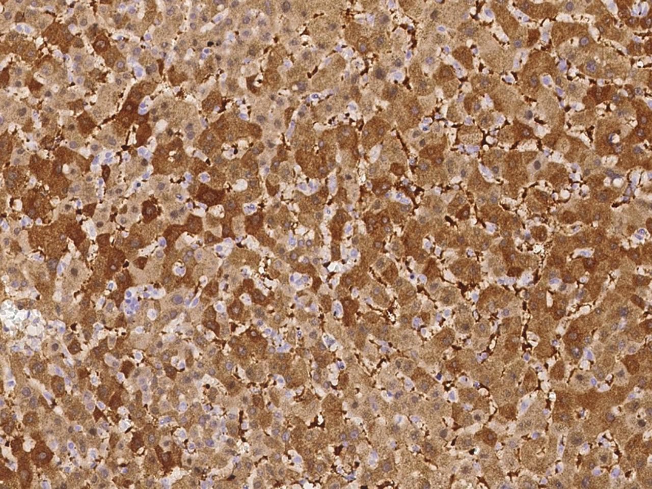 FTL / Ferritin Light Chain Antibody