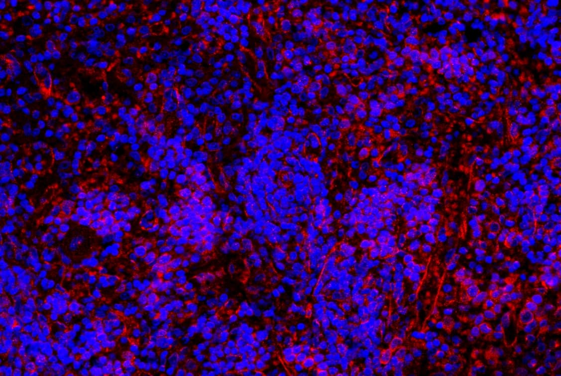 NALP3 / NLRP3 Antibody (aa12-31)