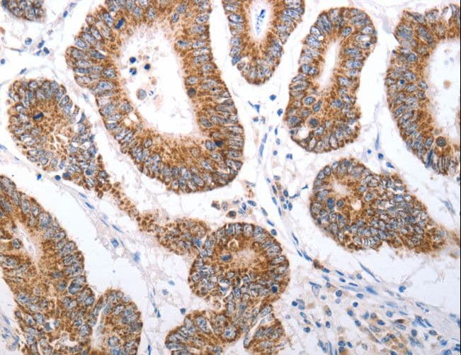 Polyclonal Rabbit anti-Human OX1R / Orexin Receptor 1 Antibody (IHC)