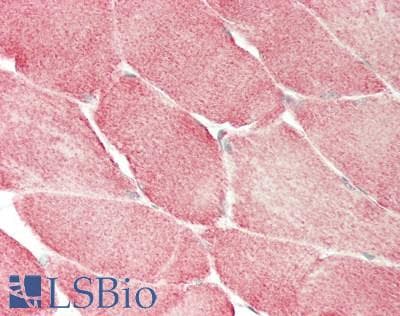 IHC-plus™ Polyclonal Rabbit anti-Human COXIV / COX4 Antibody (aa23-169, IHC, WB)