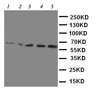 Polyclonal Rabbit anti-Mouse SLC22A5 / OCTN2 Antibody (aa531-547, WB)