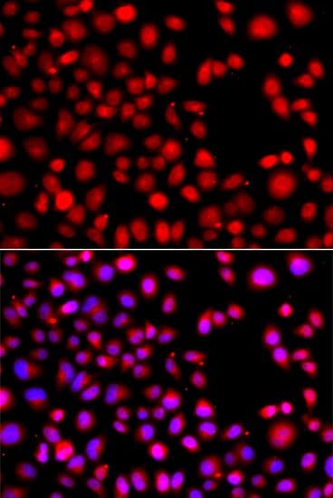 HLX1 / HLX Antibody