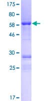 Human CCDC92 Protein (Recombinant GST)