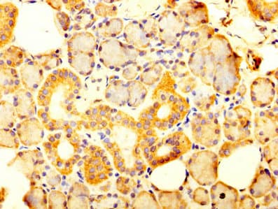 SLC12A2 / NKCC1 Antibody