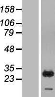 RAB7B Protein (Over-Expression Lysate Myc-DDK (Flag))