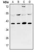 UBAC1 / KPC2 Antibody