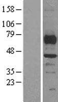SMYD3 Protein (Over-Expression Lysate Myc-DDK (Flag))