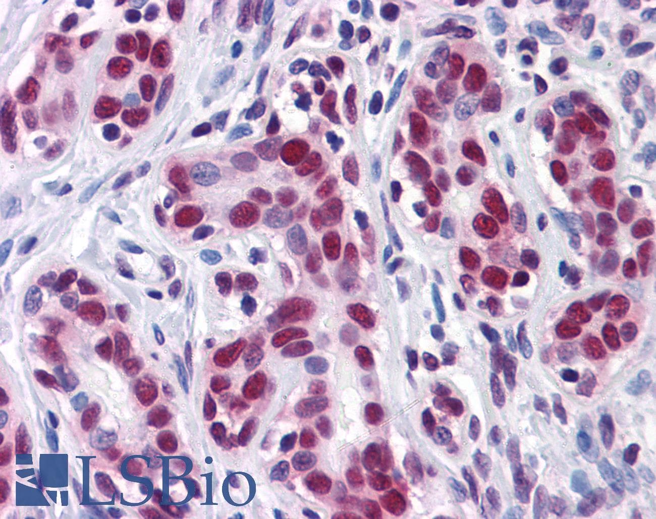 IHC-plus™ Monoclonal Mouse anti-Human ELAVL1 / HUR Antibody (clone 4G8, IHC, IF, WB)