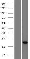 ADAT2 Protein (Over-Expression Lysate Myc-DDK (Flag))
