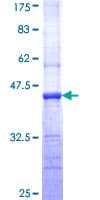 Human Tuberin / TSC2 Protein (Recombinant GST, N-terminus)