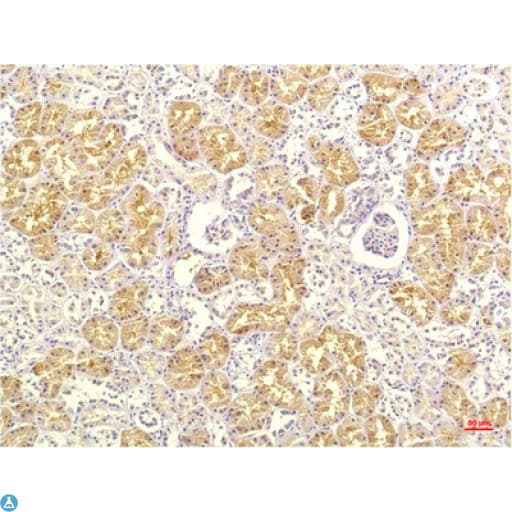 IL8 / Interleukin 8 Antibody