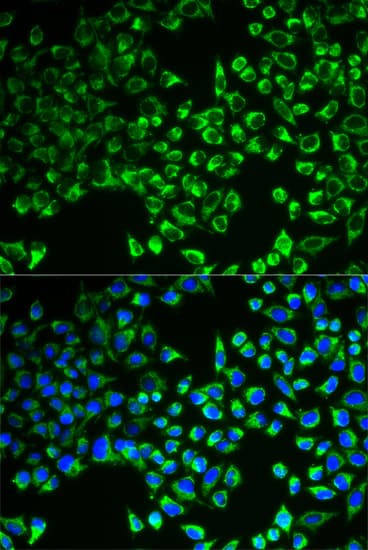 CS / Citrate Synthase Antibody