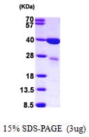Human LGALS8 / Galectin 8 Protein (Recombinant His)