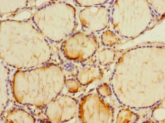 Polyclonal Rabbit anti-Human PMM2 Antibody (IHC, WB)