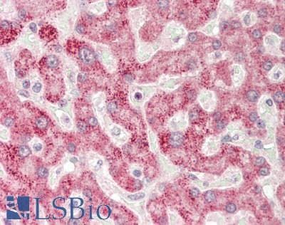 Polyclonal Rabbit anti-Human BAAT / BAT Antibody (N-Terminus, IHC, WB)
