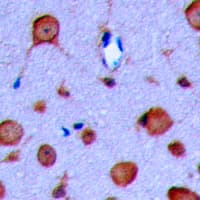 GLP1R / GLP-1 Receptor Antibody (Internal)