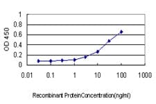 IHC-plus™ CAMKK1 Antibody (clone 1F6)