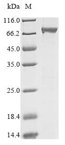 Human RECQ1 / RECQL Protein (Recombinant 10His, N-terminus)