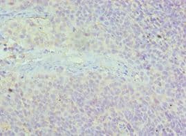 Polyclonal Rabbit anti-Human AAAS / Adracalin Antibody (aa287-546, IHC, WB)