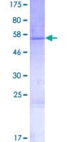Human COLEC10 Protein (Recombinant GST)