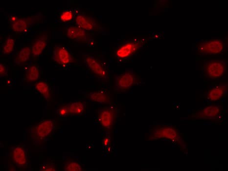 HNRNPF / hnRNP F Antibody