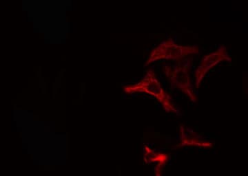 Polyclonal Rabbit anti-Human ARSA / Arylsulfatase A Antibody (IHC, IF, WB)