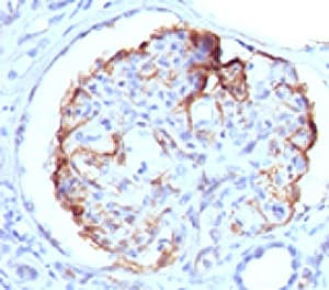 WT1 / Wilms Tumor 1 Antibody (clone WLMT1-1, Ready-to-Use)