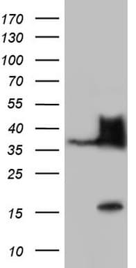 Monoclonal Mouse anti-Human NKX3-1 Antibody (clone OTI2D11, IHC, WB)