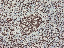 Monoclonal Mouse anti-Human NONO / P54NRB Antibody (clone OTI2E7, IHC, WB)