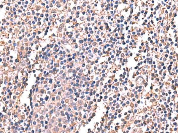 LDHAL6B Antibody