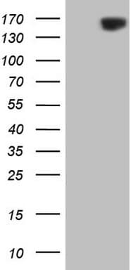 ERBB3 / HER3 Antibody (clone OTI1A9)