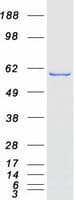 Human NMT2 Protein (Recombinant Myc-DDK (Flag))