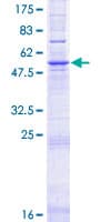 Human ELOVL2 Protein (Recombinant GST)