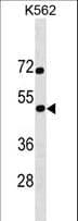 SS18L1 / CREST Antibody (aa272-300)