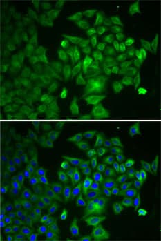 Polyclonal Rabbit anti-Human RAF1 / RAF Antibody (IHC, IF, WB)